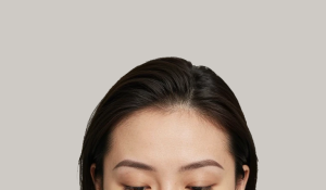 اسکالپ مو در تهران؛ راهکاری هوشمندانه برای پوشش کم‌پشتی و ریزش مو